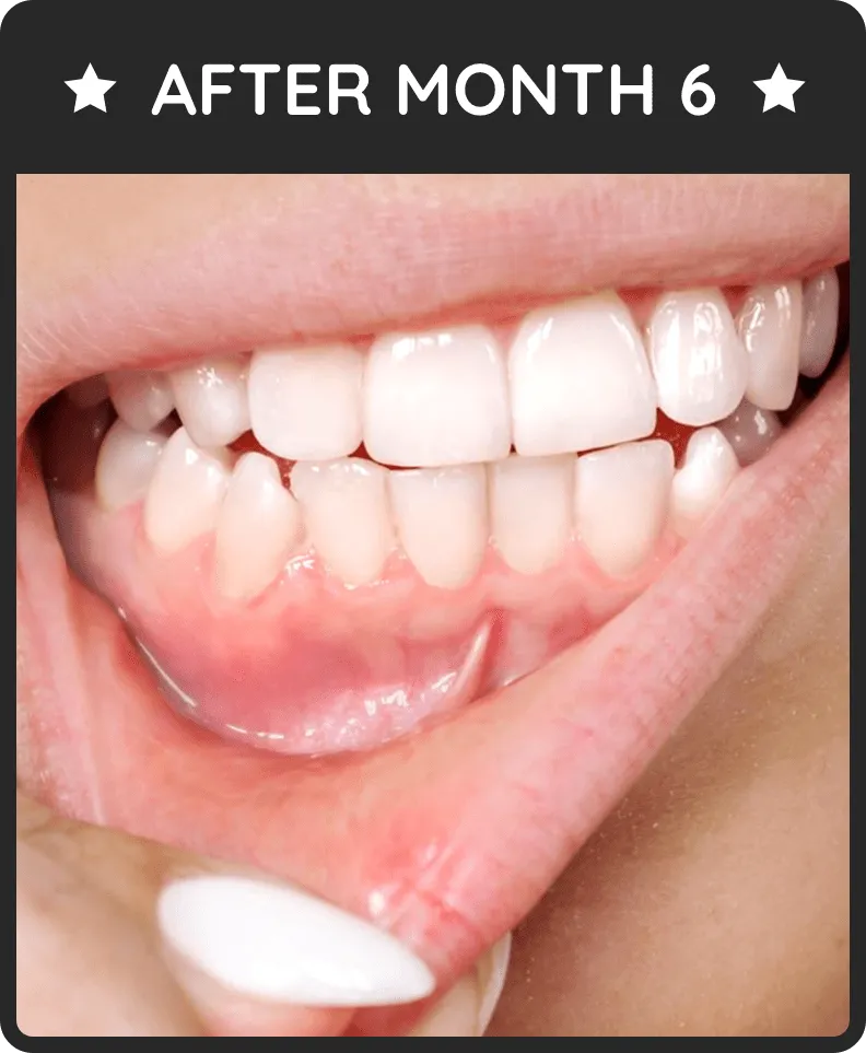 After Month 6